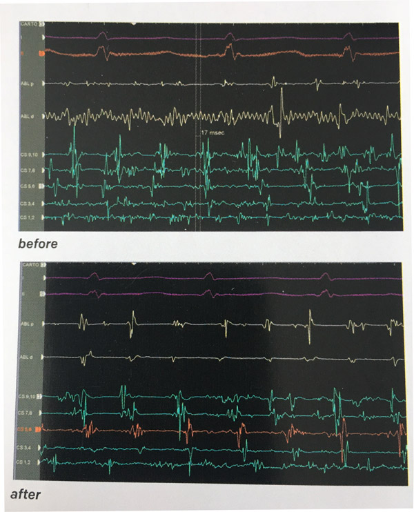 Do Power Cords Make a Difference? A Compelling Demo from Shunyata