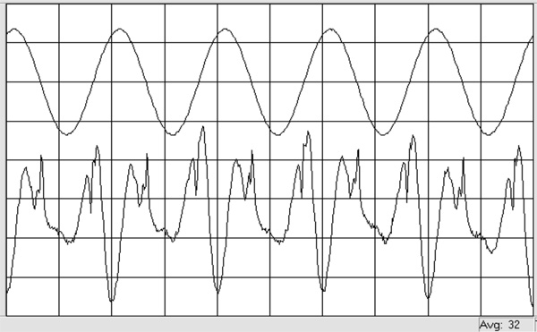 419Ver60fig08