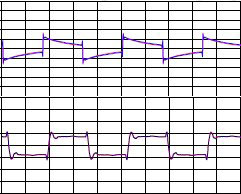 Science_InterpretingSquareWaves_ShureSE535